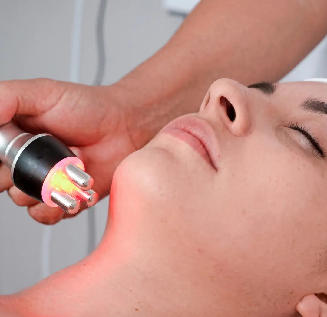 Radiofrecuencia Facial